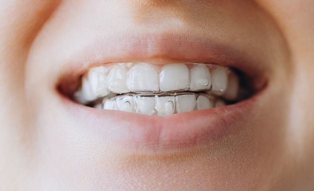 Treatment - Eastbury Dental Practice