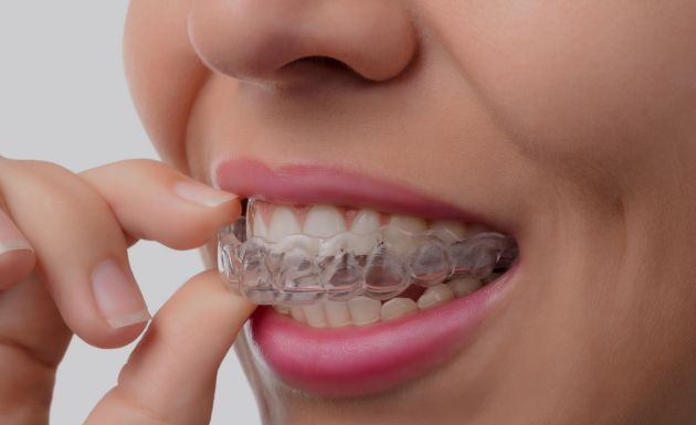 Treatment - Eastbury Dental Practice