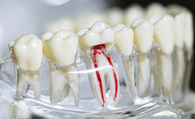 Treatment - Eastbury Dental Practice