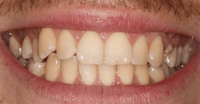 Before - Eastbury Dental Practice