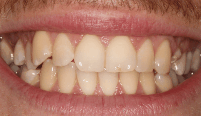 Before - Eastbury Dental Practice