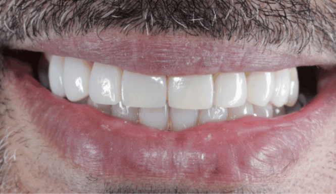 After - Eastbury Dental Practice