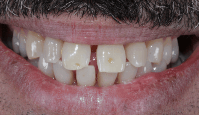 Before - Eastbury Dental Practice