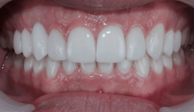 After - Eastbury Dental Practice