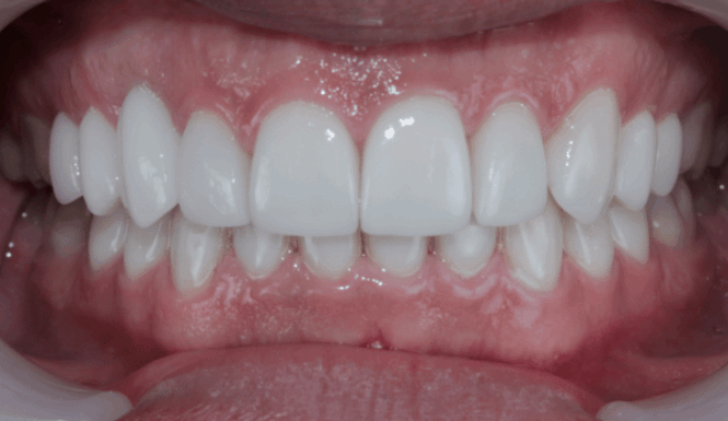 After - Eastbury Dental Practice