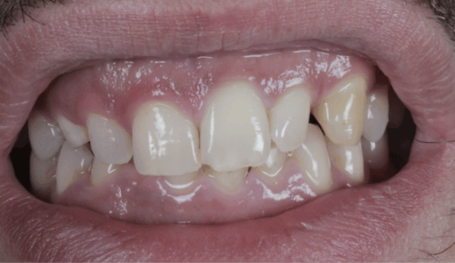 Before - Eastbury Dental Practice