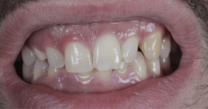 Before - Eastbury Dental Practice