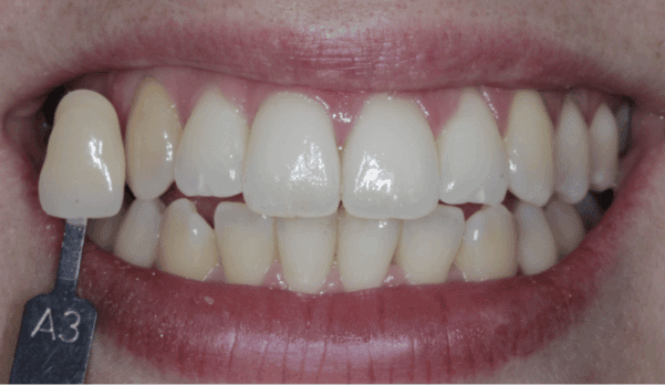 Before - Eastbury Dental Practice