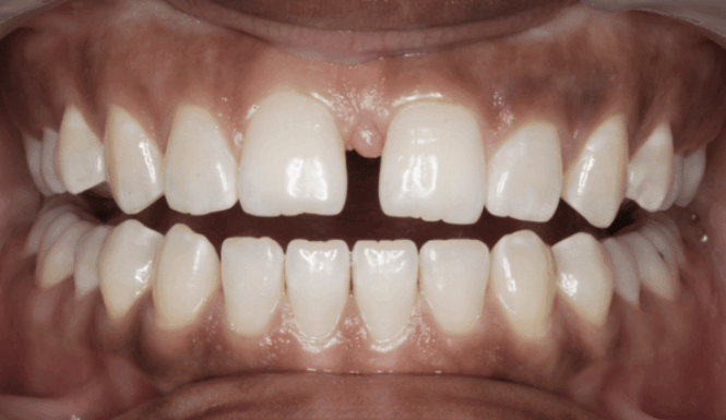 Before - Eastbury Dental Practice